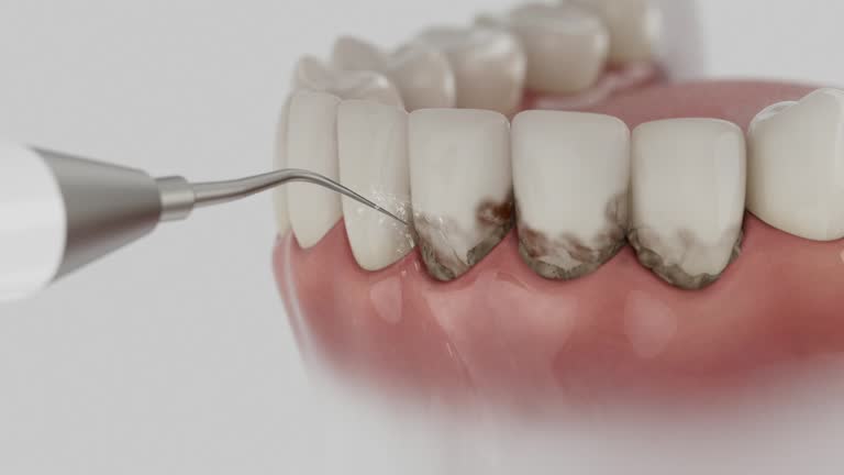 Trusted Tooth Extraction service in Gibbstown, NJ - Dentist Open Now